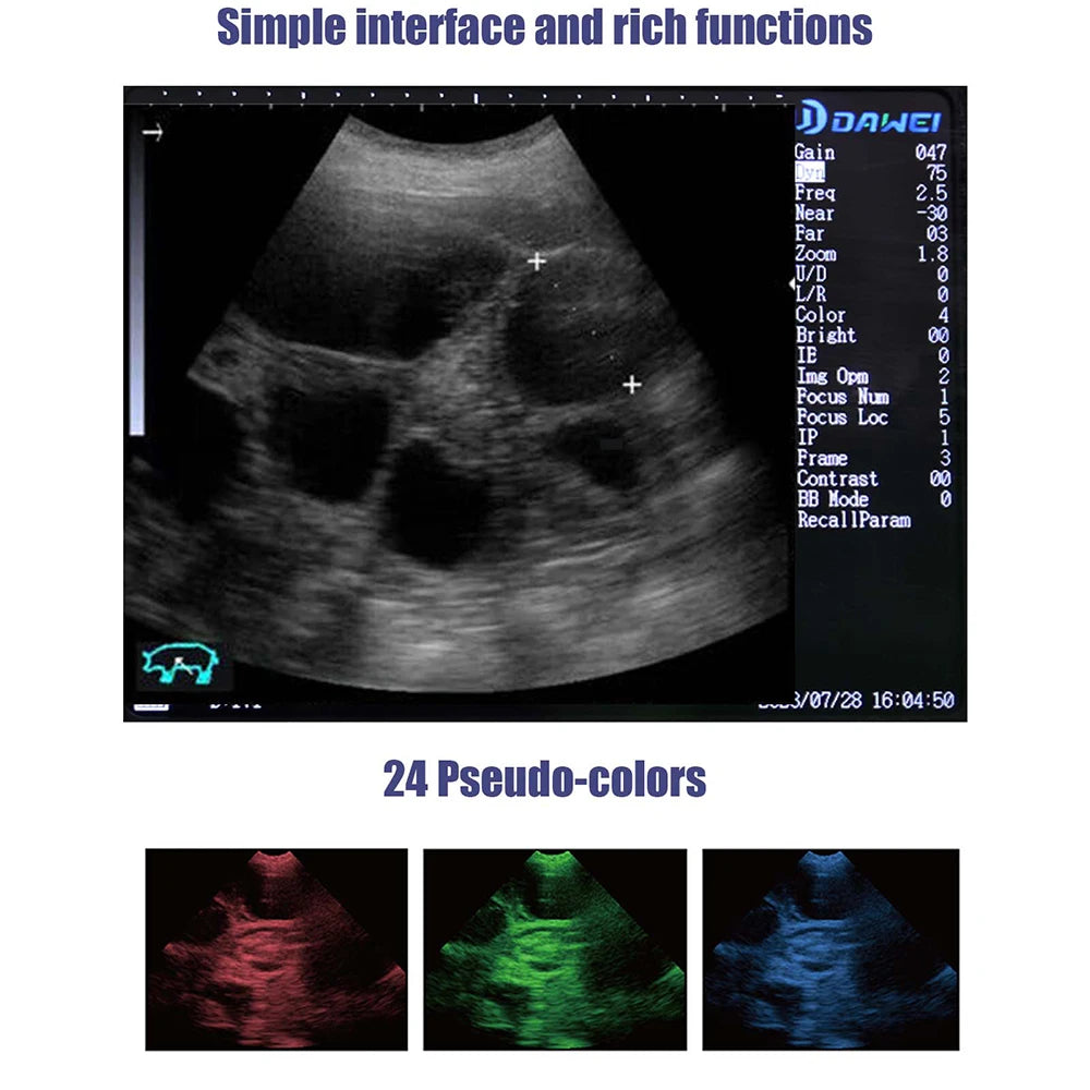 DAWEI Portable Veterinary Ultrasound Scanner B Ultra Pregnancy Machine